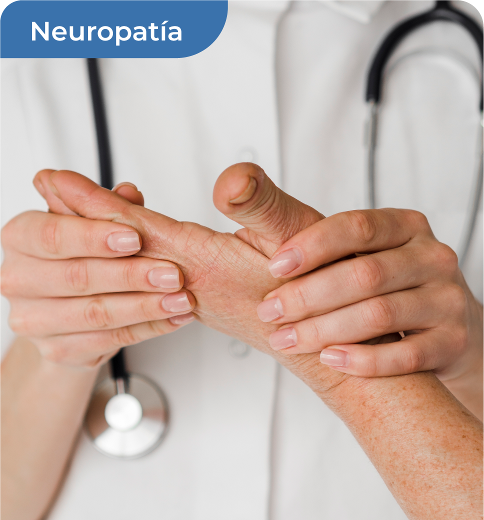 DRA. PM_Neuropatía